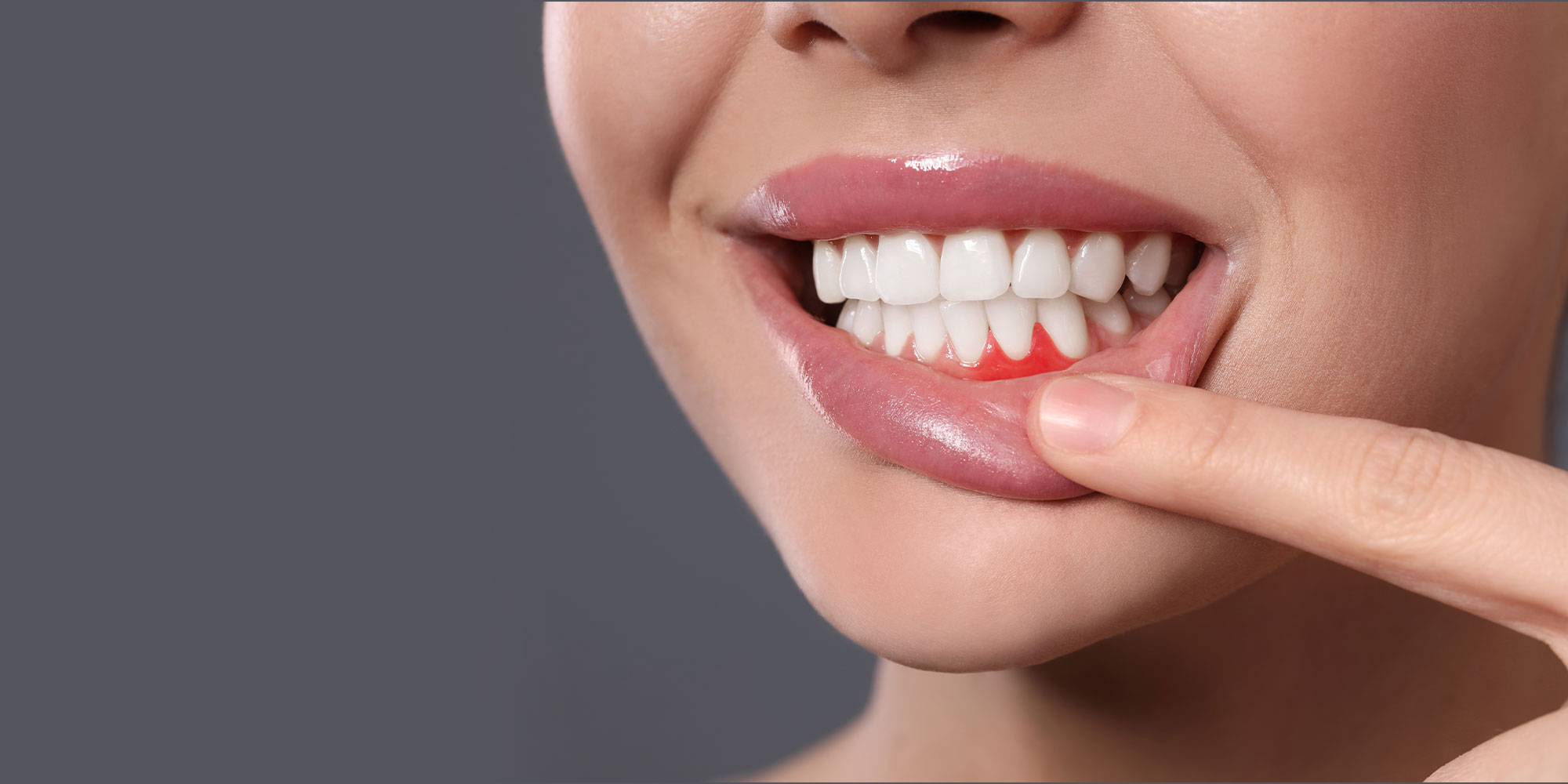 close up of patient's gum that are irritated